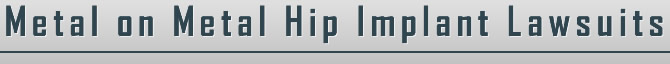 Metal on Metal Hip Implant Lawsuits