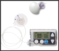 Insulin Pump